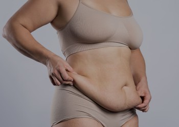 Bono PAD Abdominoplastía: Ahora Cubre Cirugía para la “Guatita de Delantal”